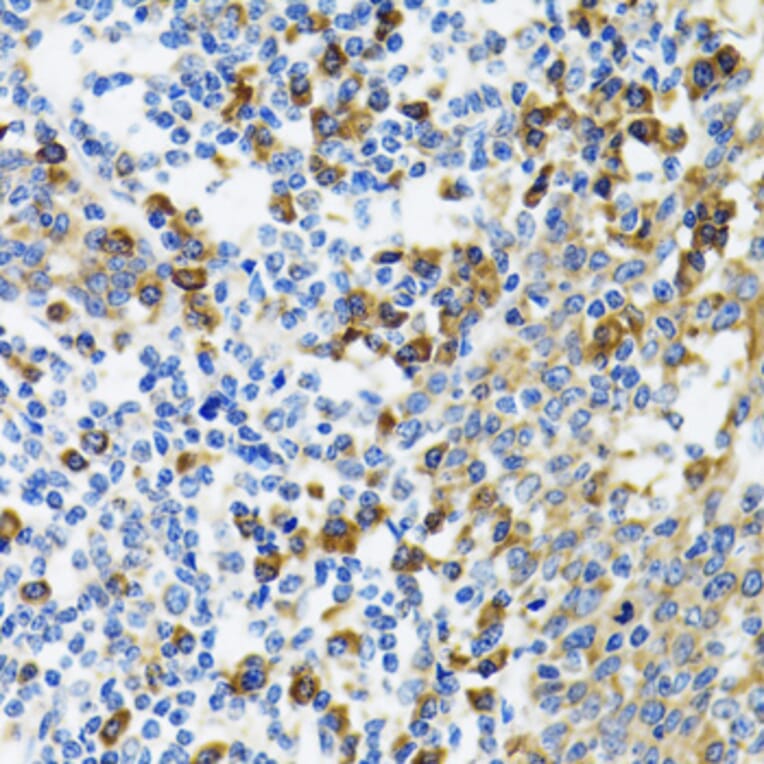 Immunohistochemistry - Anti-HYOU1 Antibody (A6625) - Antibodies.com