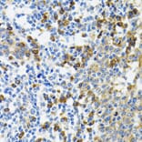 Immunohistochemistry - Anti-HYOU1 Antibody (A6625) - Antibodies.com
