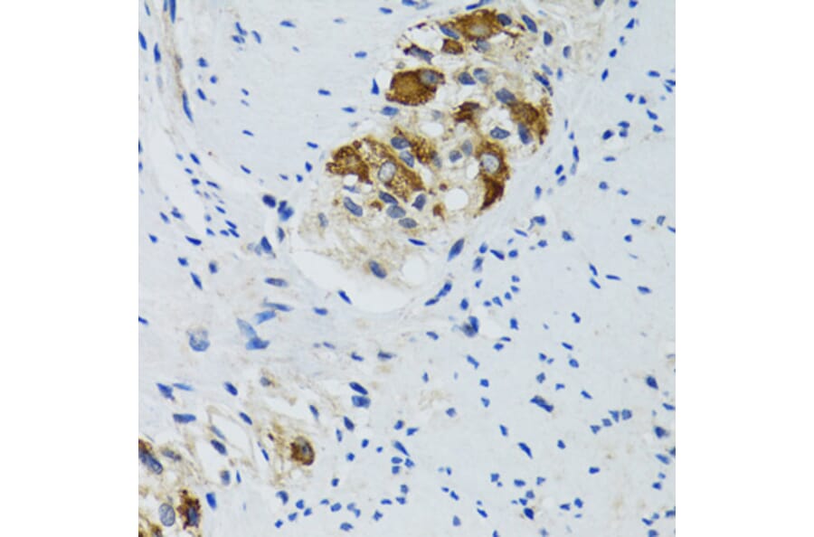 Immunohistochemistry - Anti-HYOU1 Antibody (A6625) - Antibodies.com