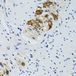 Immunohistochemistry - Anti-HYOU1 Antibody (A6625) - Antibodies.com
