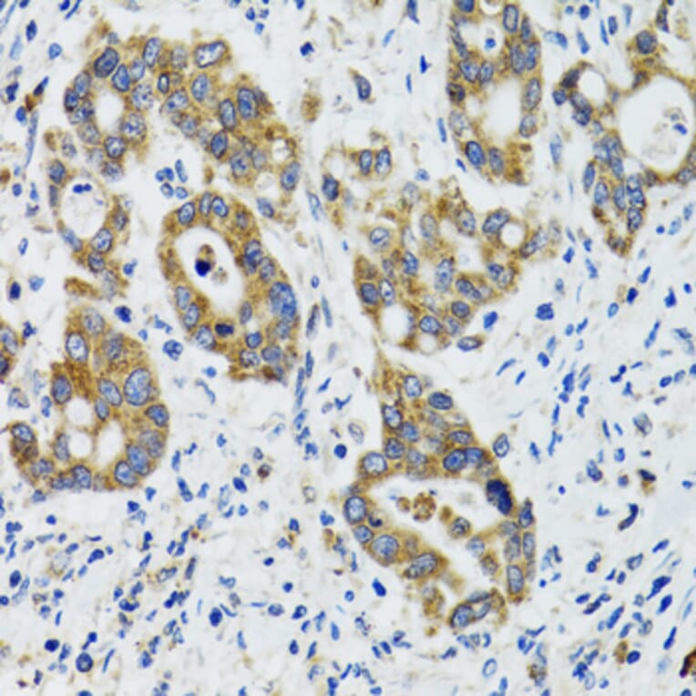 Immunohistochemistry - Anti-HYOU1 Antibody (A6625) - Antibodies.com