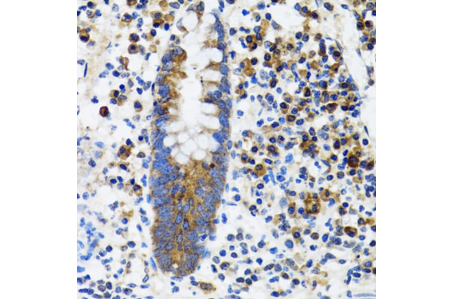 Immunohistochemistry - Anti-HYOU1 Antibody (A6625) - Antibodies.com