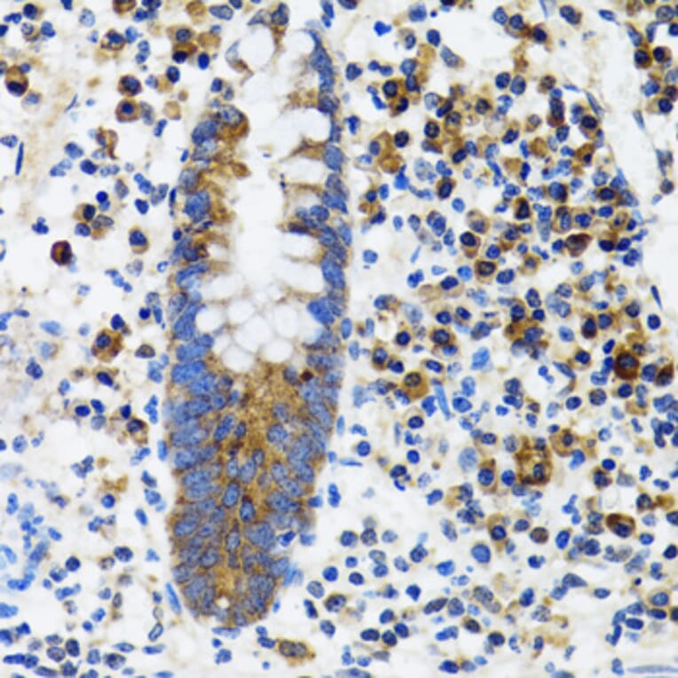 Immunohistochemistry - Anti-HYOU1 Antibody (A6625) - Antibodies.com