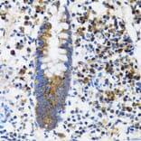 Immunohistochemistry - Anti-HYOU1 Antibody (A6625) - Antibodies.com
