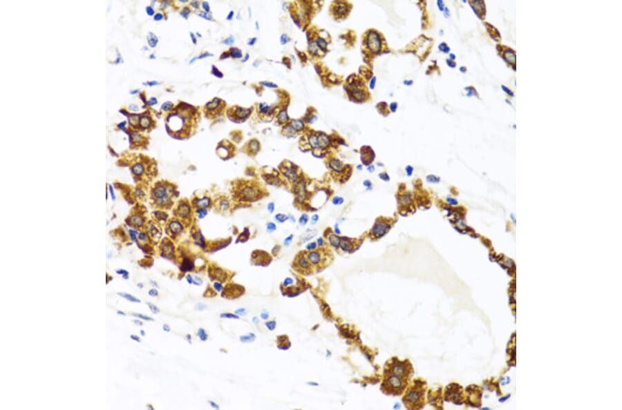Immunohistochemistry - Anti-HYOU1 Antibody (A6625) - Antibodies.com