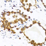 Immunohistochemistry - Anti-HYOU1 Antibody (A6625) - Antibodies.com