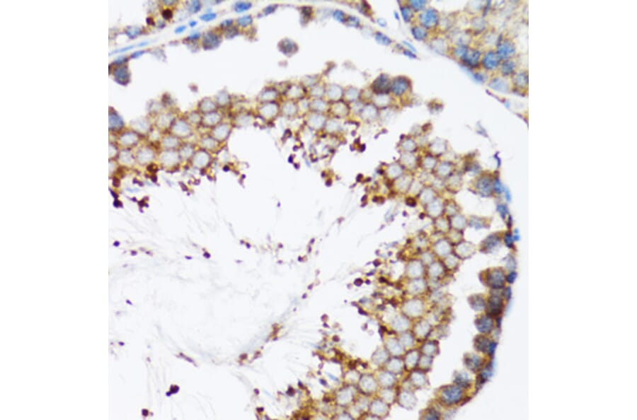 Immunohistochemistry - Anti-HYOU1 Antibody (A6625) - Antibodies.com