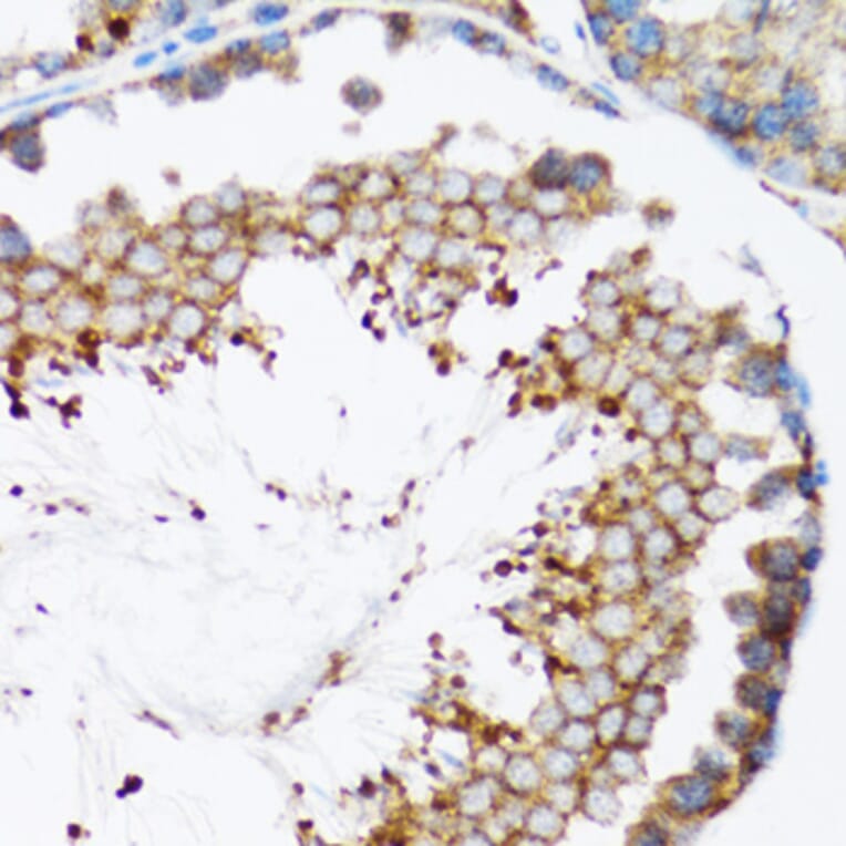 Immunohistochemistry - Anti-HYOU1 Antibody (A6625) - Antibodies.com