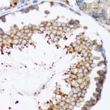 Immunohistochemistry - Anti-HYOU1 Antibody (A6625) - Antibodies.com