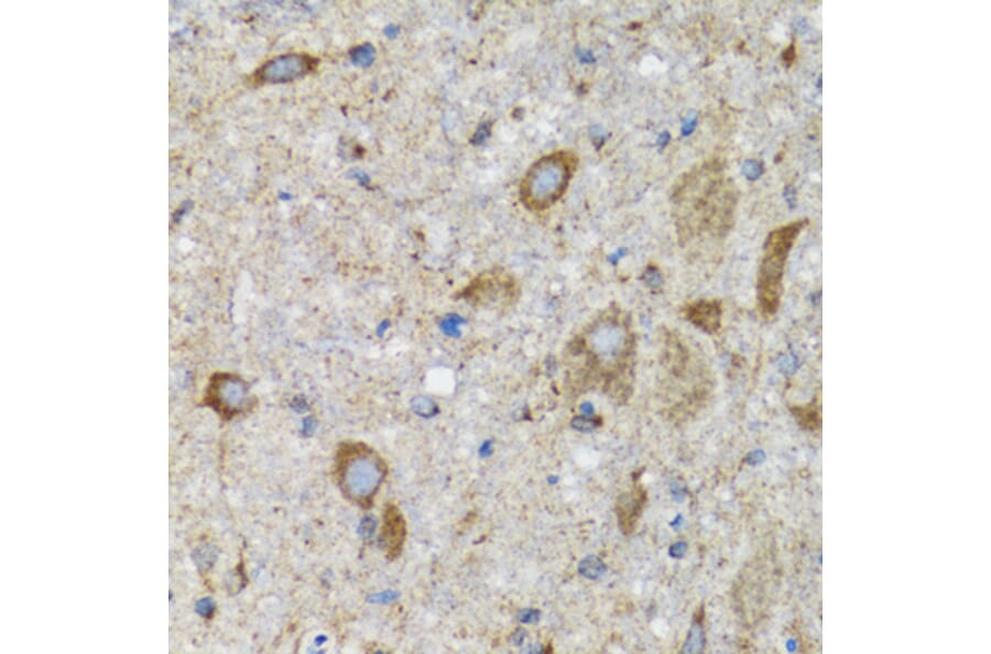 Immunohistochemistry - Anti-HYOU1 Antibody (A6625) - Antibodies.com