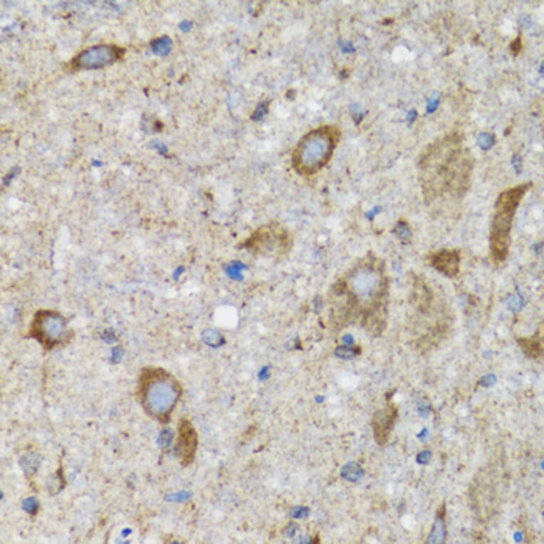 Immunohistochemistry - Anti-HYOU1 Antibody (A6625) - Antibodies.com