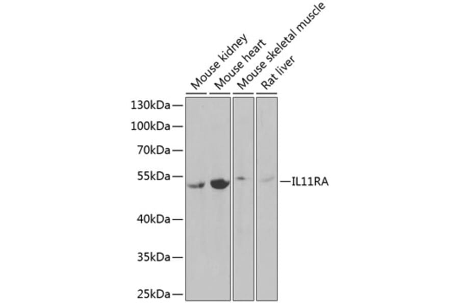 Western Blot - Anti-IL-11RA Antibody (A9946) - Antibodies.com