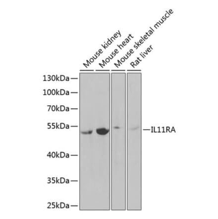 Western Blot - Anti-IL-11RA Antibody (A9946) - Antibodies.com