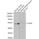 Western Blot - Anti-IL-11RA Antibody (A9946) - Antibodies.com