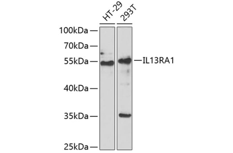 Western Blot - Anti-IL-13 receptor alpha 1 Antibody (A9947) - Antibodies.com
