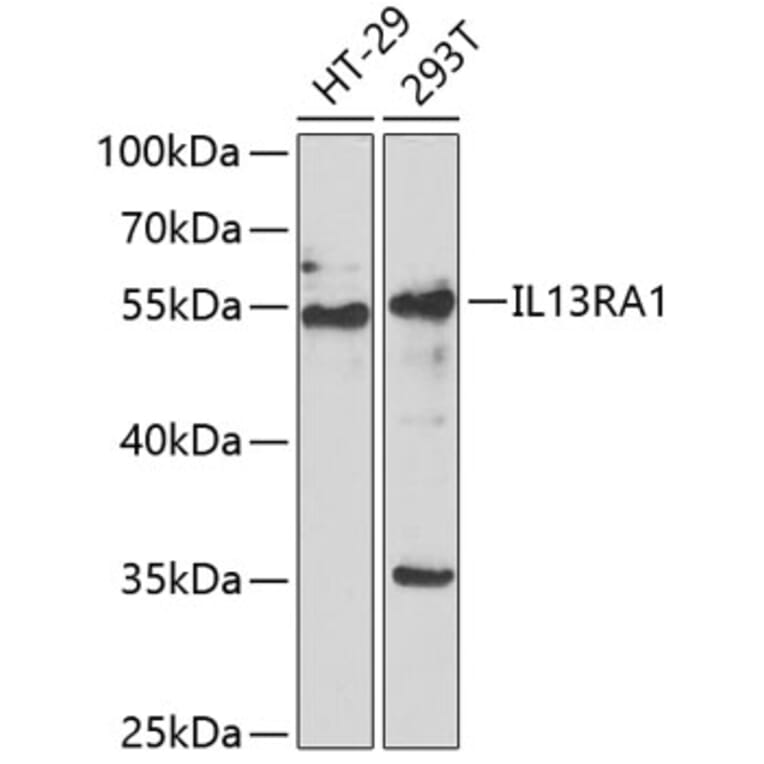 Western Blot - Anti-IL-13 receptor alpha 1 Antibody (A9947) - Antibodies.com