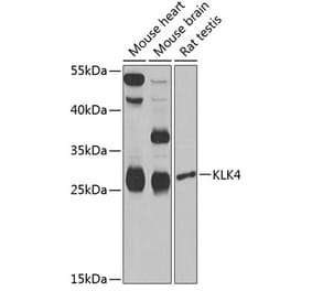 Western Blot - Anti-Kallikrein 4 Antibody (A9949) - Antibodies.com