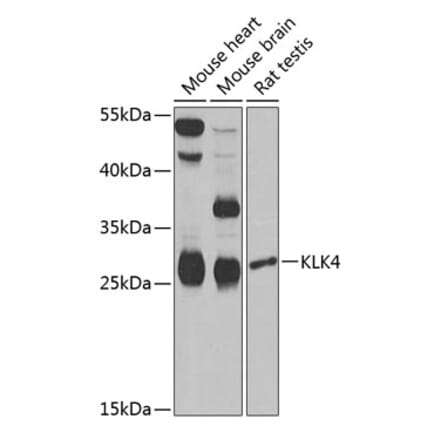 Western Blot - Anti-Kallikrein 4 Antibody (A9949) - Antibodies.com