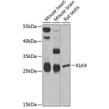 Western Blot - Anti-Kallikrein 4 Antibody (A9949) - Antibodies.com