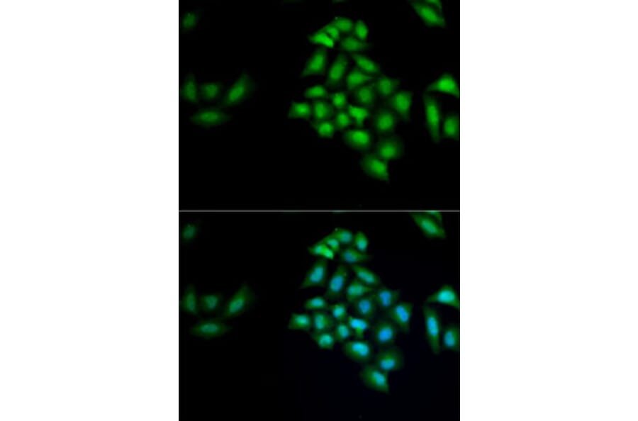Immunofluorescence - Anti-Kallikrein 4 Antibody (A9949) - Antibodies.com