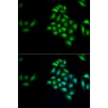 Immunofluorescence - Anti-Kallikrein 4 Antibody (A9949) - Antibodies.com