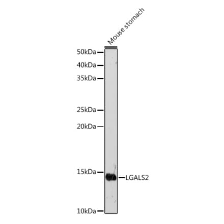 Western Blot - Anti-Galectin 2 Antibody (A9950) - Antibodies.com