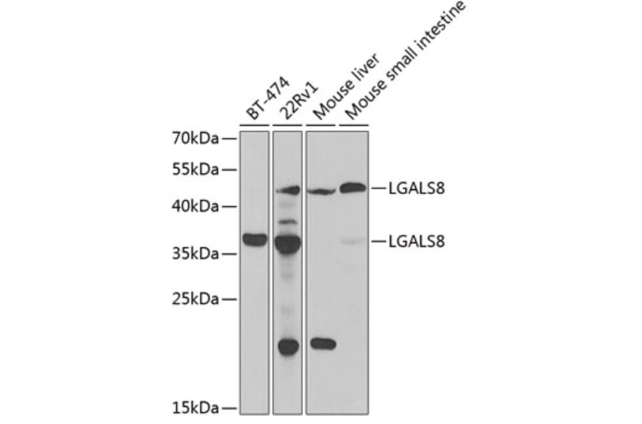 Western Blot - Anti-LGALS8 Antibody (A6646) - Antibodies.com