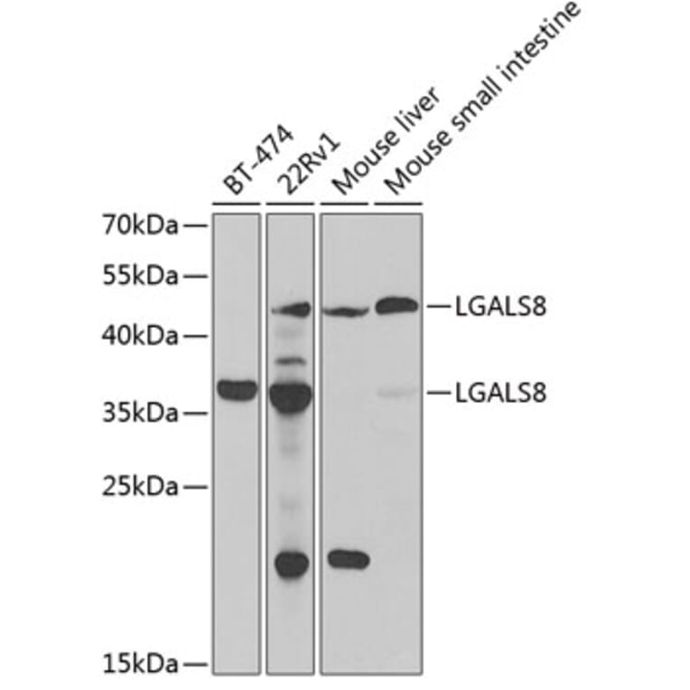 Western Blot - Anti-LGALS8 Antibody (A6646) - Antibodies.com