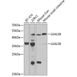 Western Blot - Anti-LGALS8 Antibody (A6646) - Antibodies.com