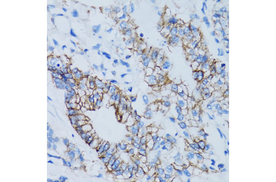 Immunohistochemistry - Anti-LGALS8 Antibody (A6646) - Antibodies.com