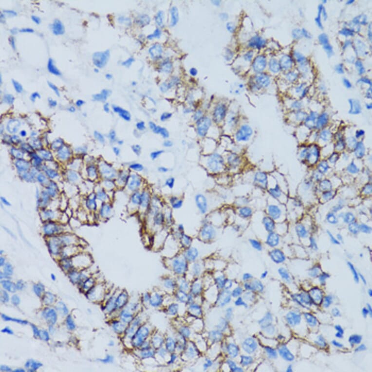 Immunohistochemistry - Anti-LGALS8 Antibody (A6646) - Antibodies.com