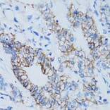 Immunohistochemistry - Anti-LGALS8 Antibody (A6646) - Antibodies.com