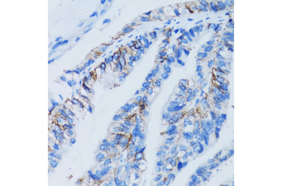Immunohistochemistry - Anti-LGALS8 Antibody (A6646) - Antibodies.com