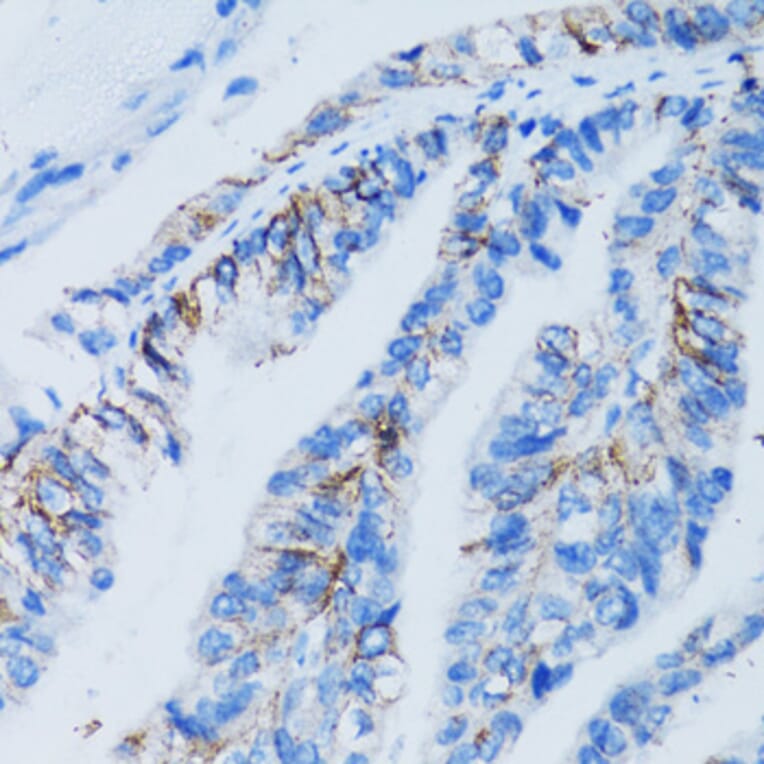 Immunohistochemistry - Anti-LGALS8 Antibody (A6646) - Antibodies.com