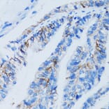 Immunohistochemistry - Anti-LGALS8 Antibody (A6646) - Antibodies.com