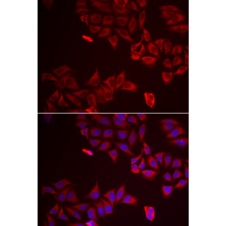 Immunofluorescence - Anti-LGALS8 Antibody (A6646) - Antibodies.com