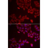 Immunofluorescence - Anti-LGALS8 Antibody (A6646) - Antibodies.com