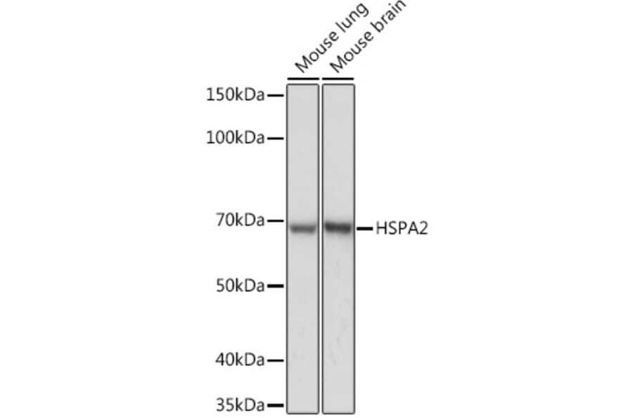 Western Blot - Anti-HSPA2 Antibody [ARC1415] (A9952) - Antibodies.com