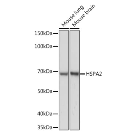 Western Blot - Anti-HSPA2 Antibody [ARC1415] (A9952) - Antibodies.com