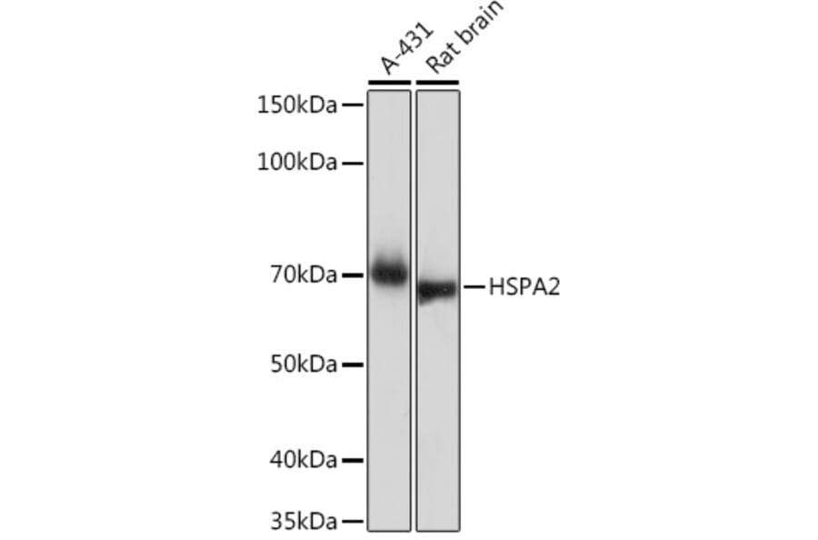 Western Blot - Anti-HSPA2 Antibody [ARC1415] (A9952) - Antibodies.com