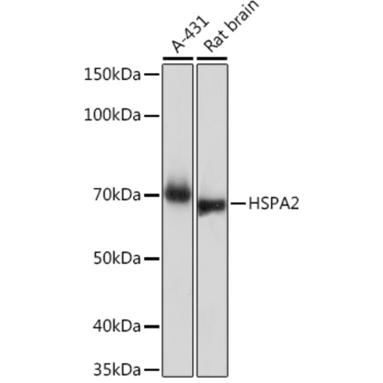 Western Blot - Anti-HSPA2 Antibody [ARC1415] (A9952) - Antibodies.com