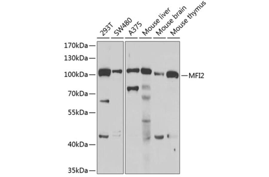 Western Blot - Anti-MFI2/MTf Antibody (A9953) - Antibodies.com