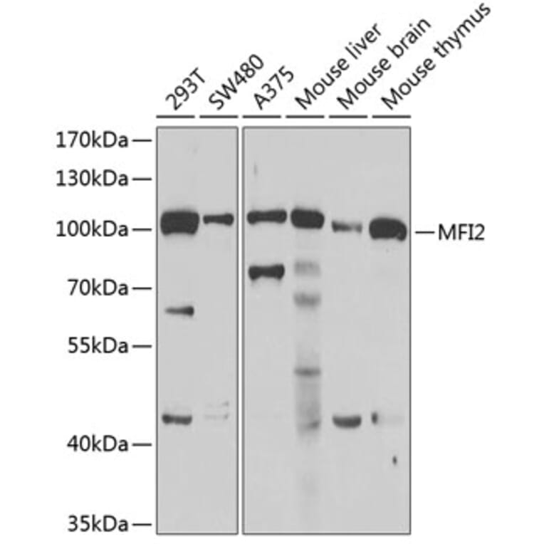 Western Blot - Anti-MFI2/MTf Antibody (A9953) - Antibodies.com