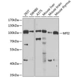 Western Blot - Anti-MFI2/MTf Antibody (A9953) - Antibodies.com