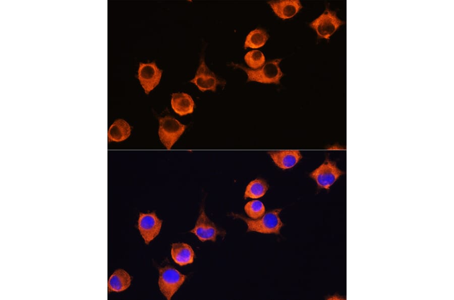 Immunofluorescence - Anti-MFI2/MTf Antibody (A9953) - Antibodies.com