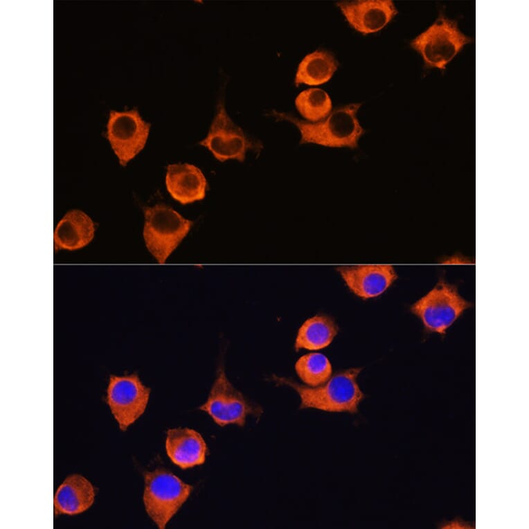Immunofluorescence - Anti-MFI2/MTf Antibody (A9953) - Antibodies.com