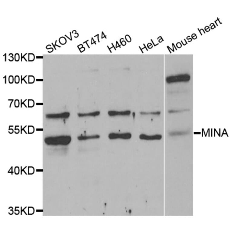 Western Blot - Anti-MINA Antibody (A6655) - Antibodies.com
