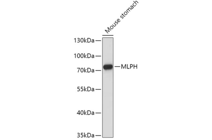 Western Blot - Anti-MLPH Antibody (A9955) - Antibodies.com