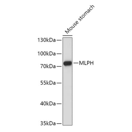 Western Blot - Anti-MLPH Antibody (A9955) - Antibodies.com