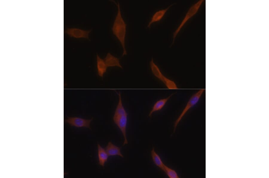 Immunofluorescence - Anti-MLPH Antibody (A9955) - Antibodies.com
